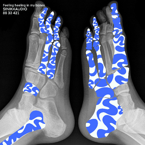 BONE HEALING LIGHT CODE (88 33 421)