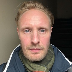 THE SUN CANT COMPARE breaks edit