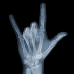 Deda Catero - Understand prod feppa II