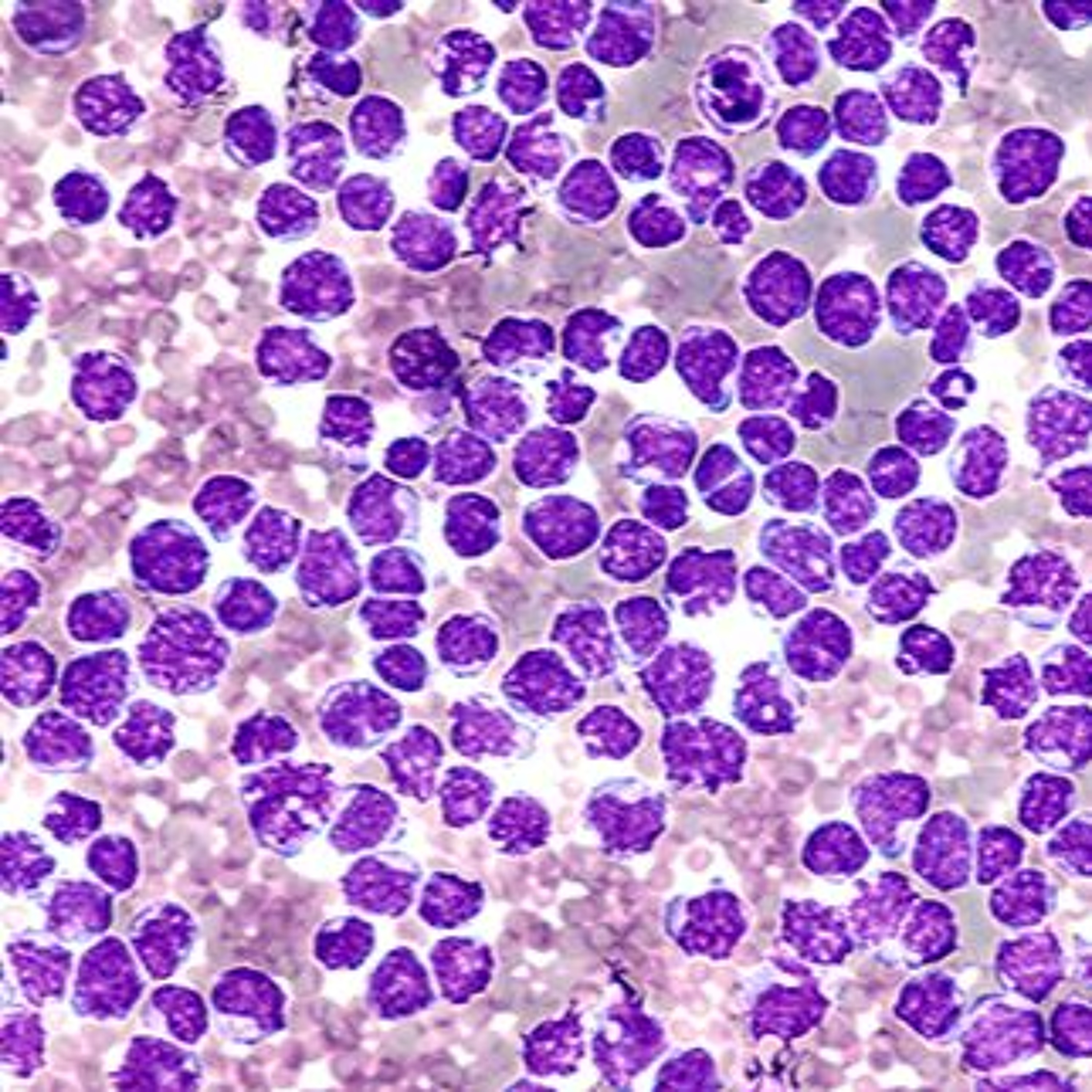 Oncotarget
