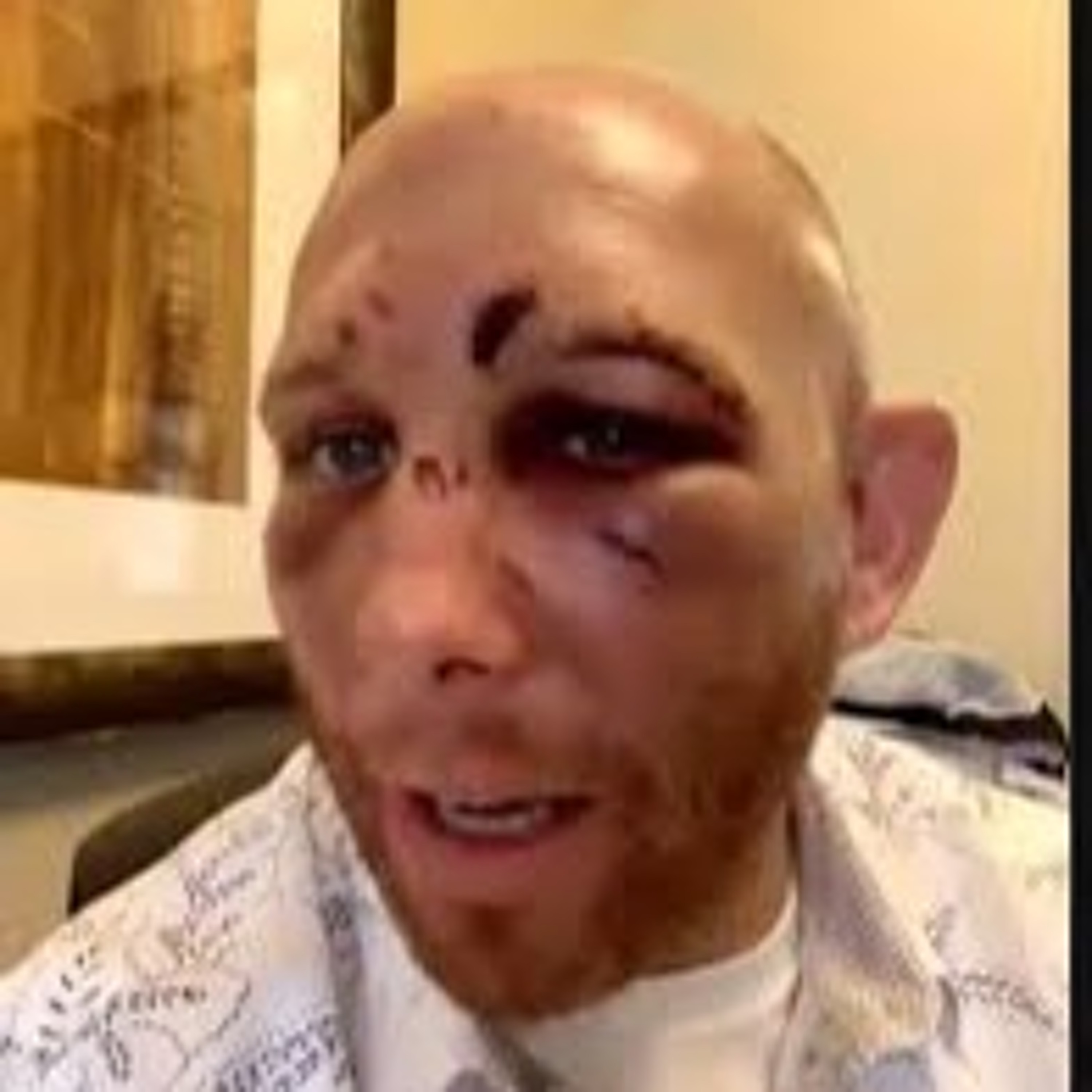 HTHB Shoulder Strikes MMA Podcast Ep. 56: "UFC Austin" with Matt McSweeney and Ty Capone thumbnail