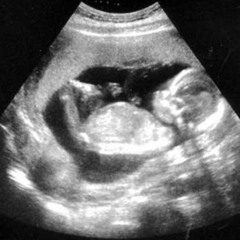 Baidin Fheilimi (Irlanda)