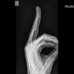 PALO (OUTRO) GLOOSITO MEDIO MIX