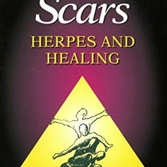 [PDF] ❤️ Read Erasing Scars: Herpes and Healing by  Dr. James D. Okun MD &  Evangelita Goodwell