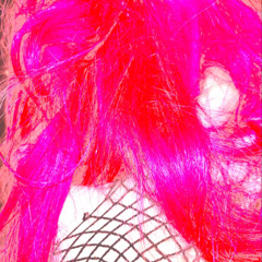 traction alopecia