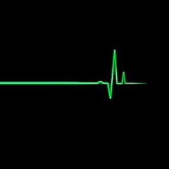 심방세동 (A - Fib)