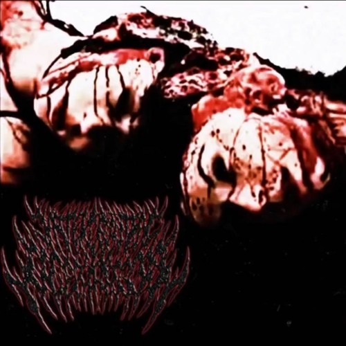 INTERCRANIAL LACERATION - TORTURE THAT WORTHLESS SLUT