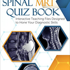 Read EPUB 💝 Spinal MRI Quiz Book: Interactive Teaching Files Designed to Hone Your D