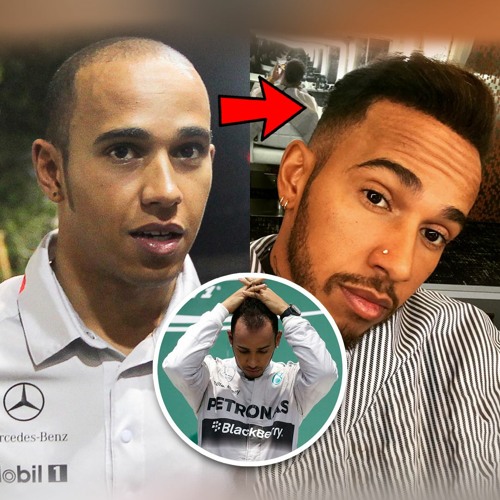 Stream episode Lewis Hamilton Denies Hair Transplant And Attributes ...