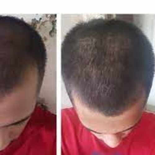 Stream Detumescence Morphic Field by sukrut khambete | Listen 