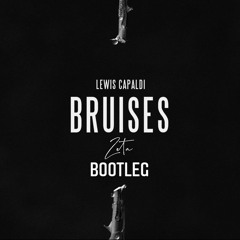 Lewis Capaldi - Bruises (Zeta Bootleg) #FreeDL