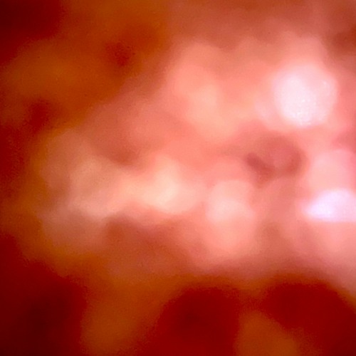 Lightning and Fire