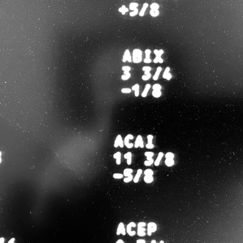 Obracam Głowę | ANNA (Ta Której Nie Ma)