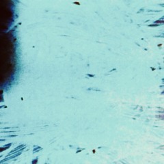 [ʀinit alɛʁʒik]                                        rhinite allergique