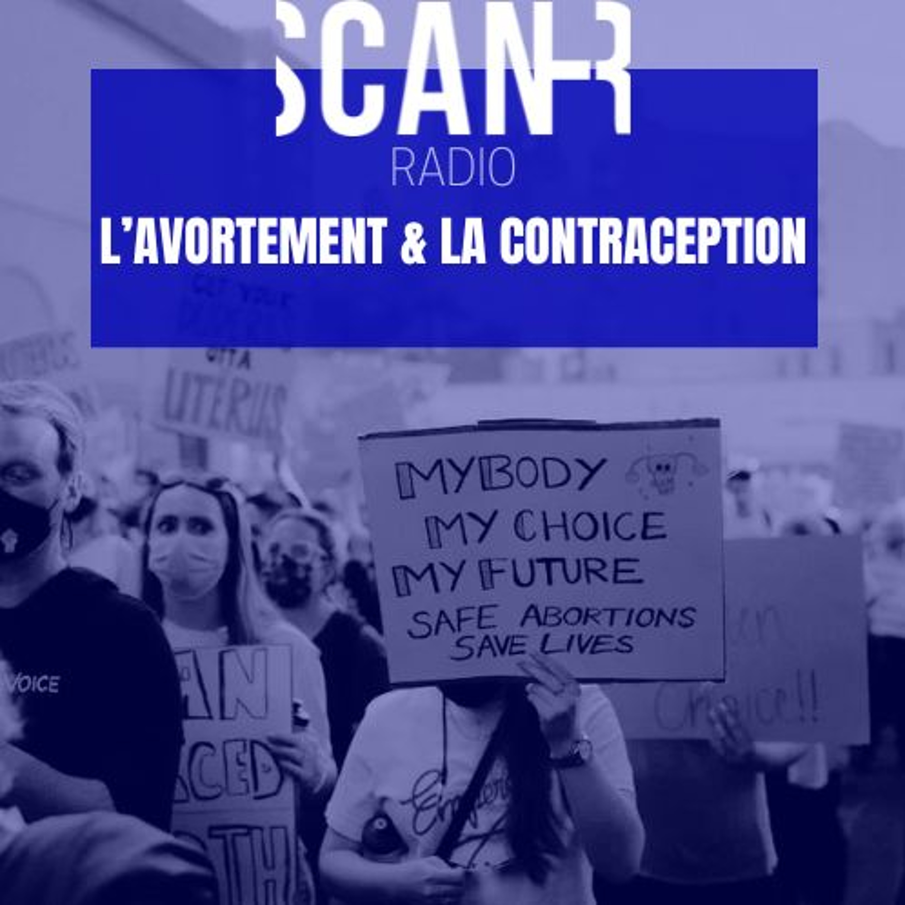 Scan-R Radio : Emission du 27 mars 2024 sur l'avortement et la contraception episode artwork