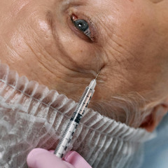 Dr. JoDee Anderson, MD | Navigating Dermal Filler Durations