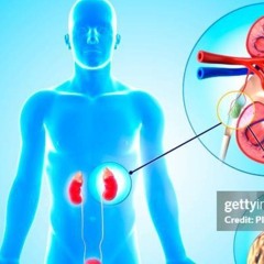 Kidney Stones On Acid