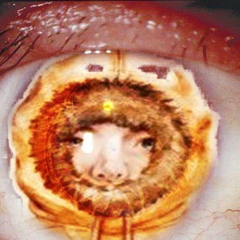 in your eye