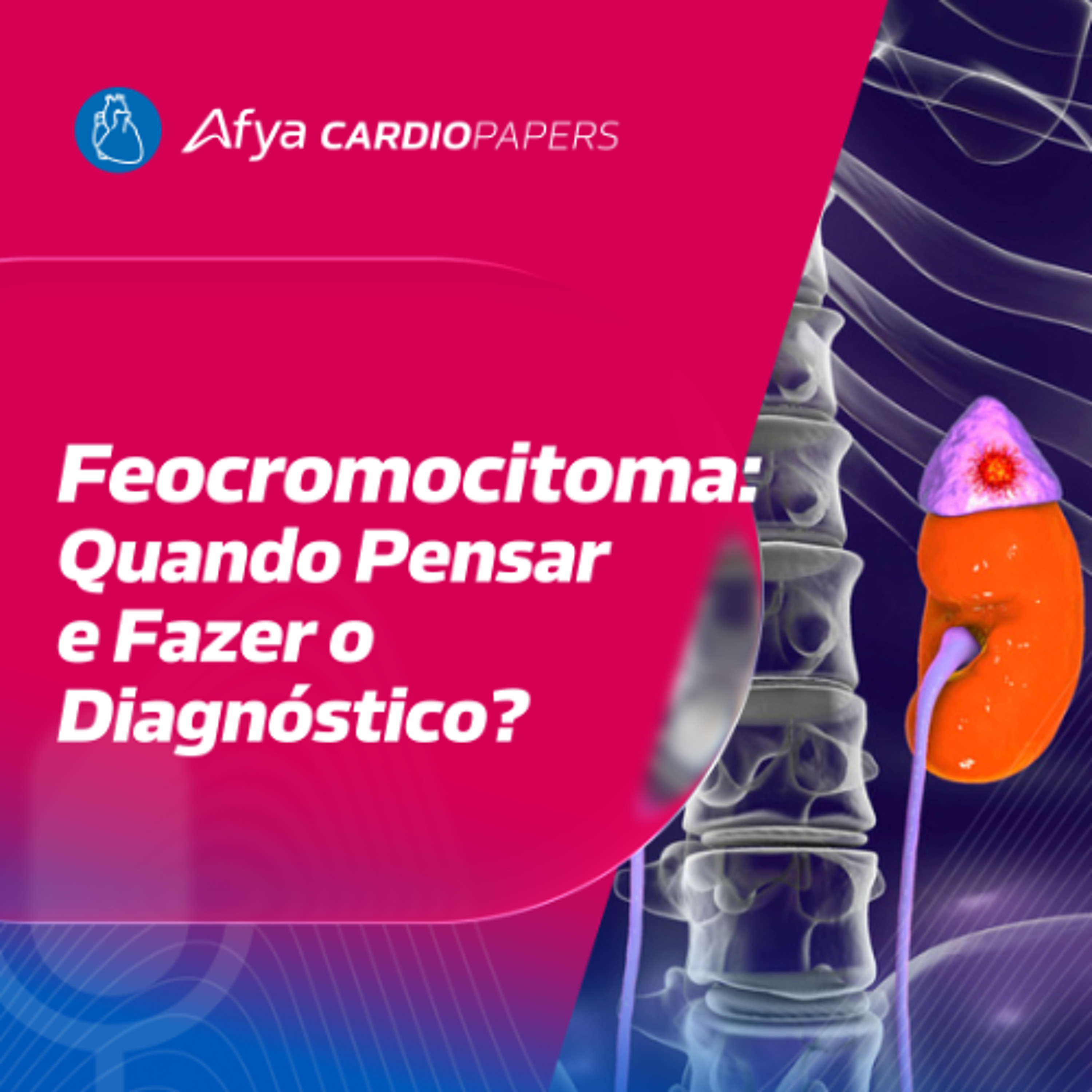 Picos Pressóricos + Suor + Palpitação? Feocromocitoma?
