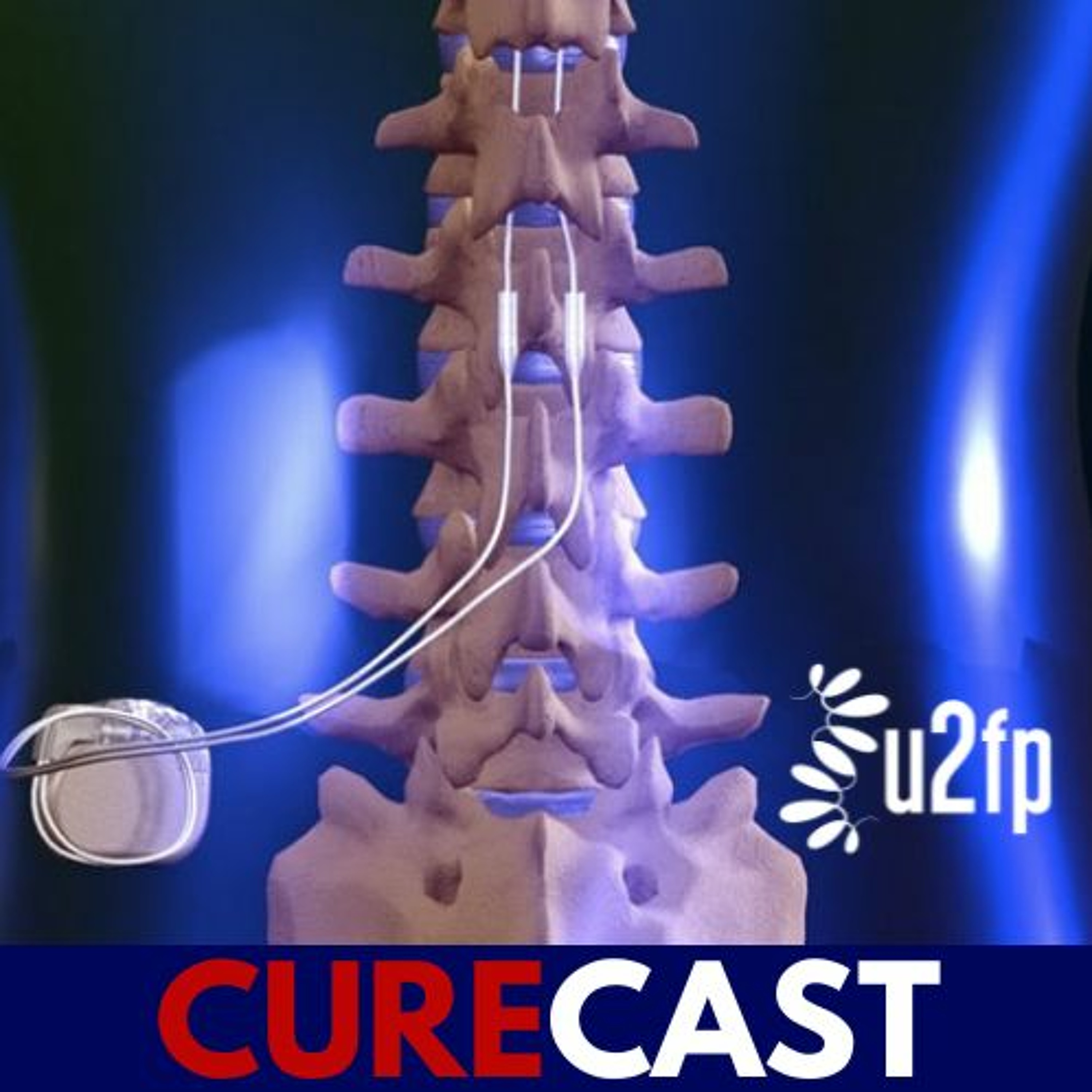 U2FP CureCast