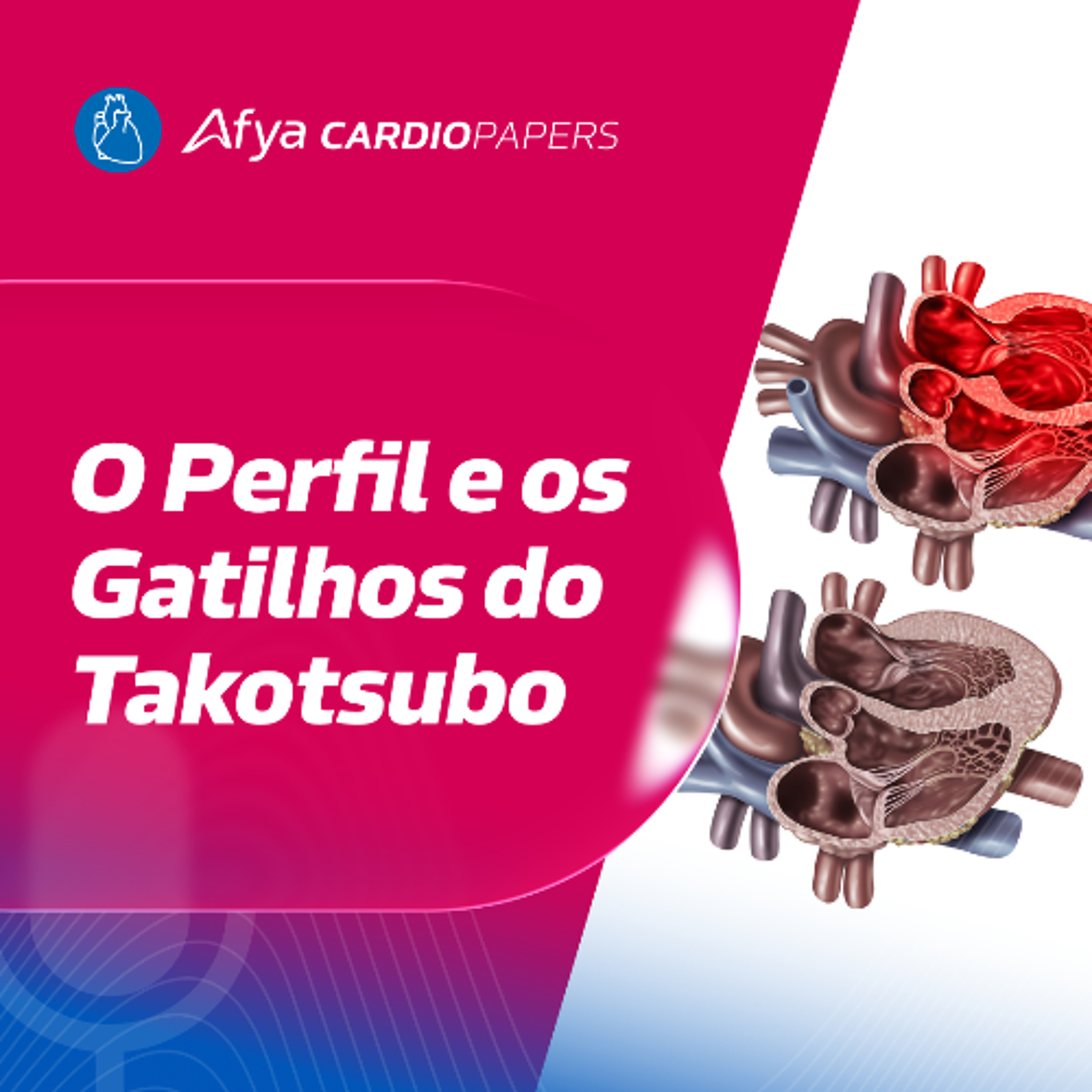 O Perfil e os Gatilhos do Takotsubo