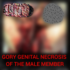 Gory Genital Necrosis of the Male Member FULL SPLIT with ExTxPxOxE