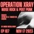 Artwork for Operation XRAY EP 107 - Nov 17 2023