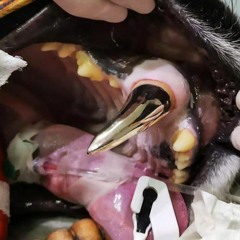 Gold tooth