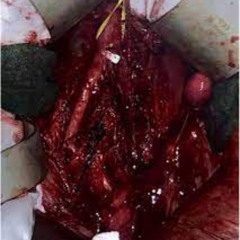 hatelifehatemusichatemyfriendshatemyselfhateeveryone