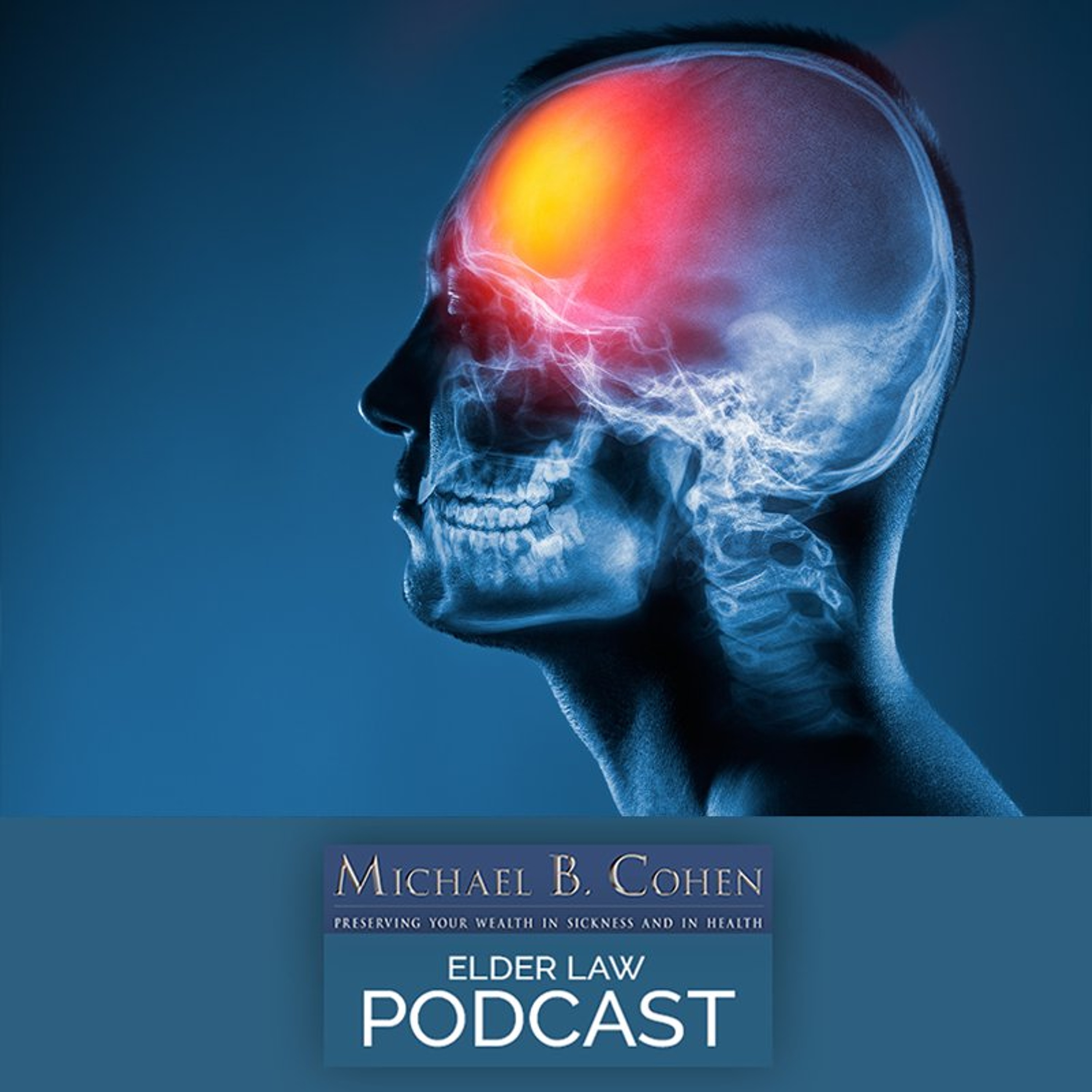 If Cte Cannot Be Diagnosed Until After Death, When Could Muhammed Ali, Bobby Hull, John Niland or Junior Seau No Longer Sign a Will? episode artwork