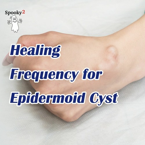 Healing Frequency for Epidermoid Cyst - Spooky2 Rife Frequency Healing