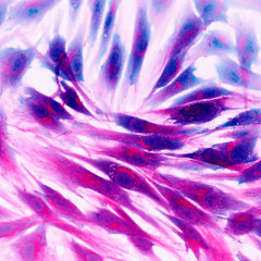 Skin Rejuvenation: How Young Blood and Bone Marrow Influence It