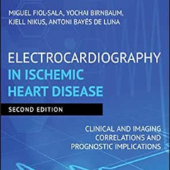 [DOWNLOAD] PDF 📦 Electrocardiography in Ischemic Heart Disease: Clinical and Imaging