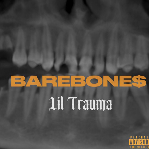 WOOZY (FEAT.Elijah.EXE/ PROD. Lil Rambo beats)