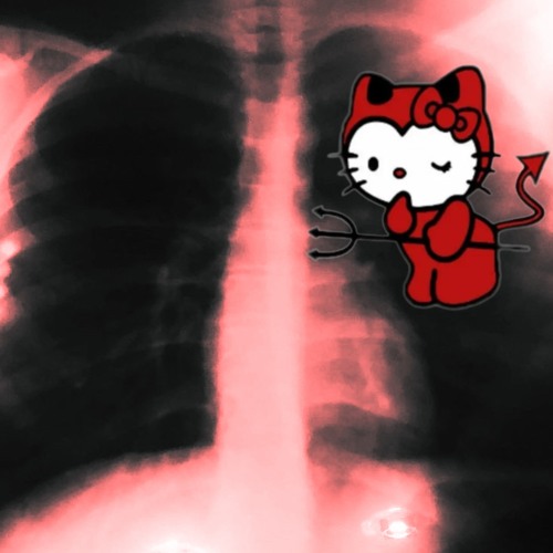 CODE10 - HeLLov3