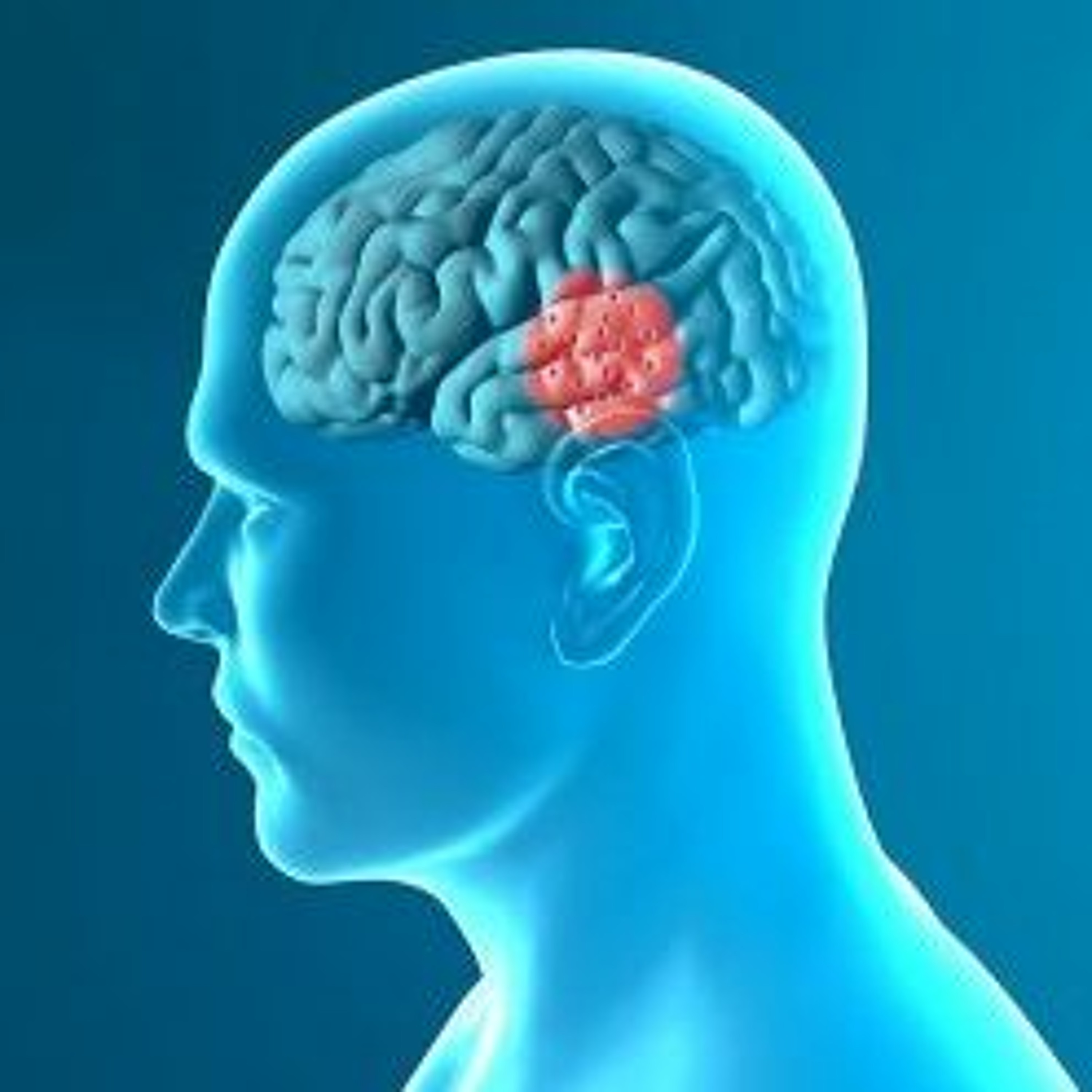 Evidence Based Physio Podcast