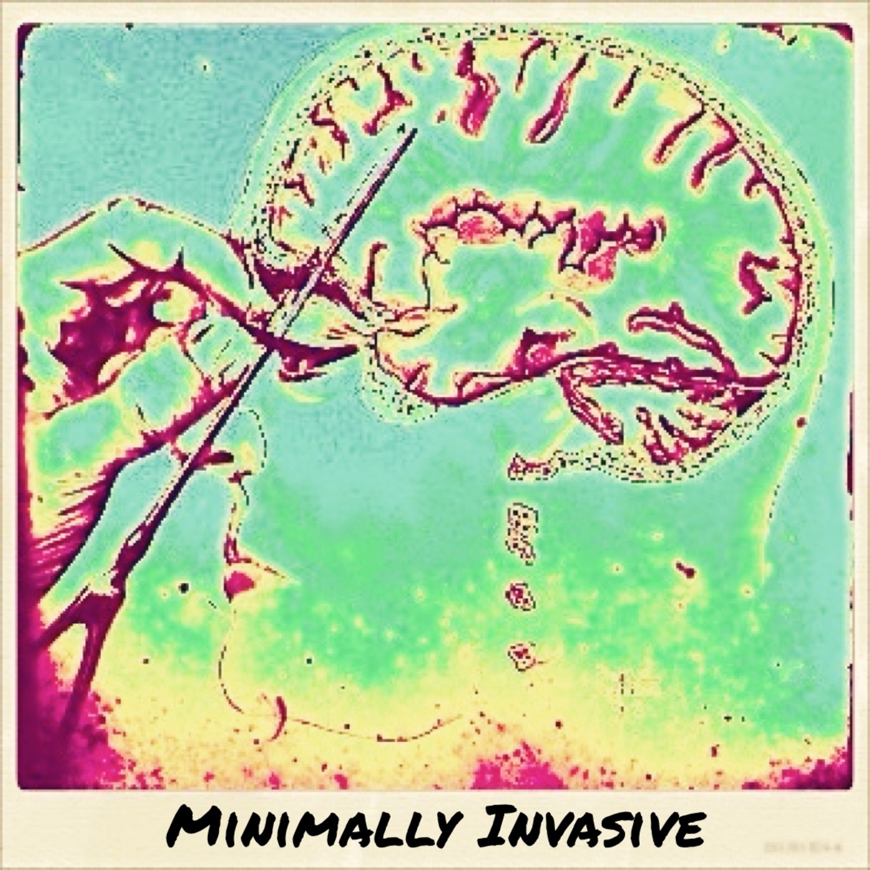 Minimally Invasive episode artwork