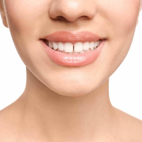 (beat) gaps in her teeth 130bpm
