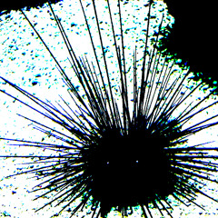 Euechinoidea
