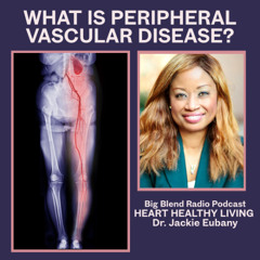 What Is Peripheral Vascular Disease?