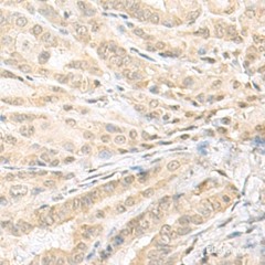 Homeobox Protein EMX1