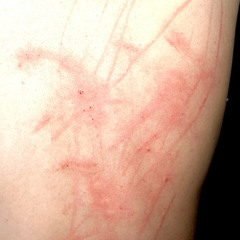 INFINITYISDEAD - demolitionluvrrs (prod. Willie G x Dogfoodmedia)