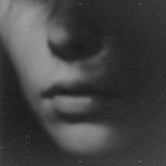 Scars