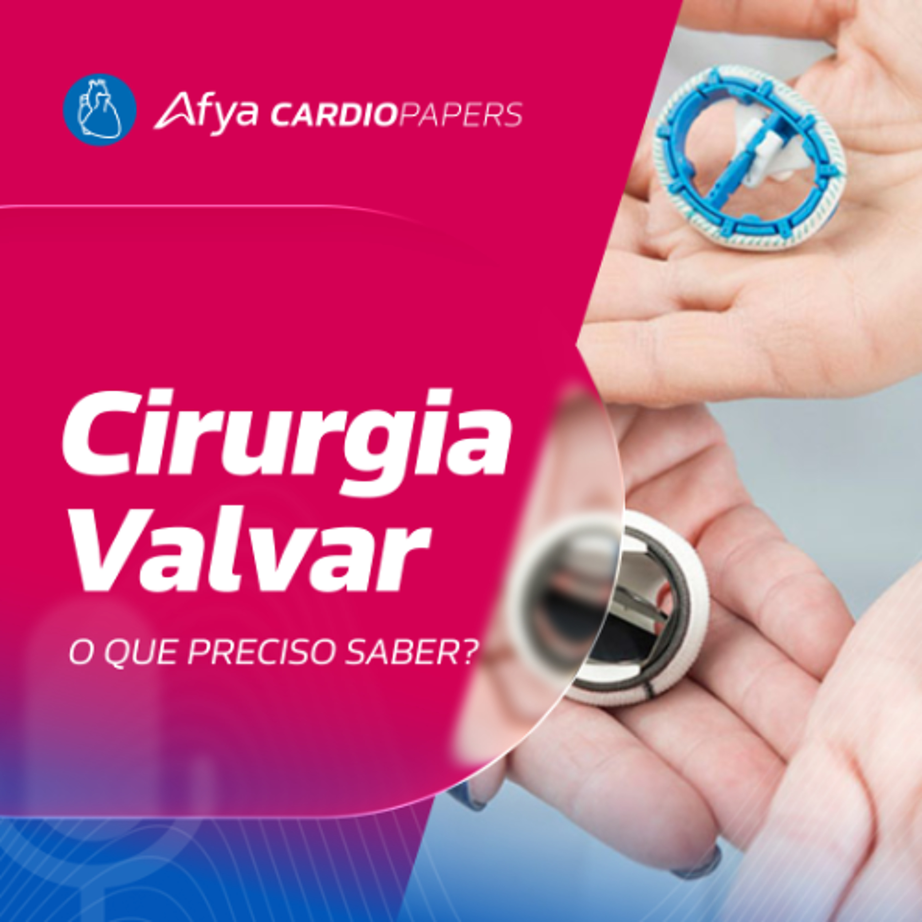 O que o Cardio precisa saber sobre cirurgia valvar?