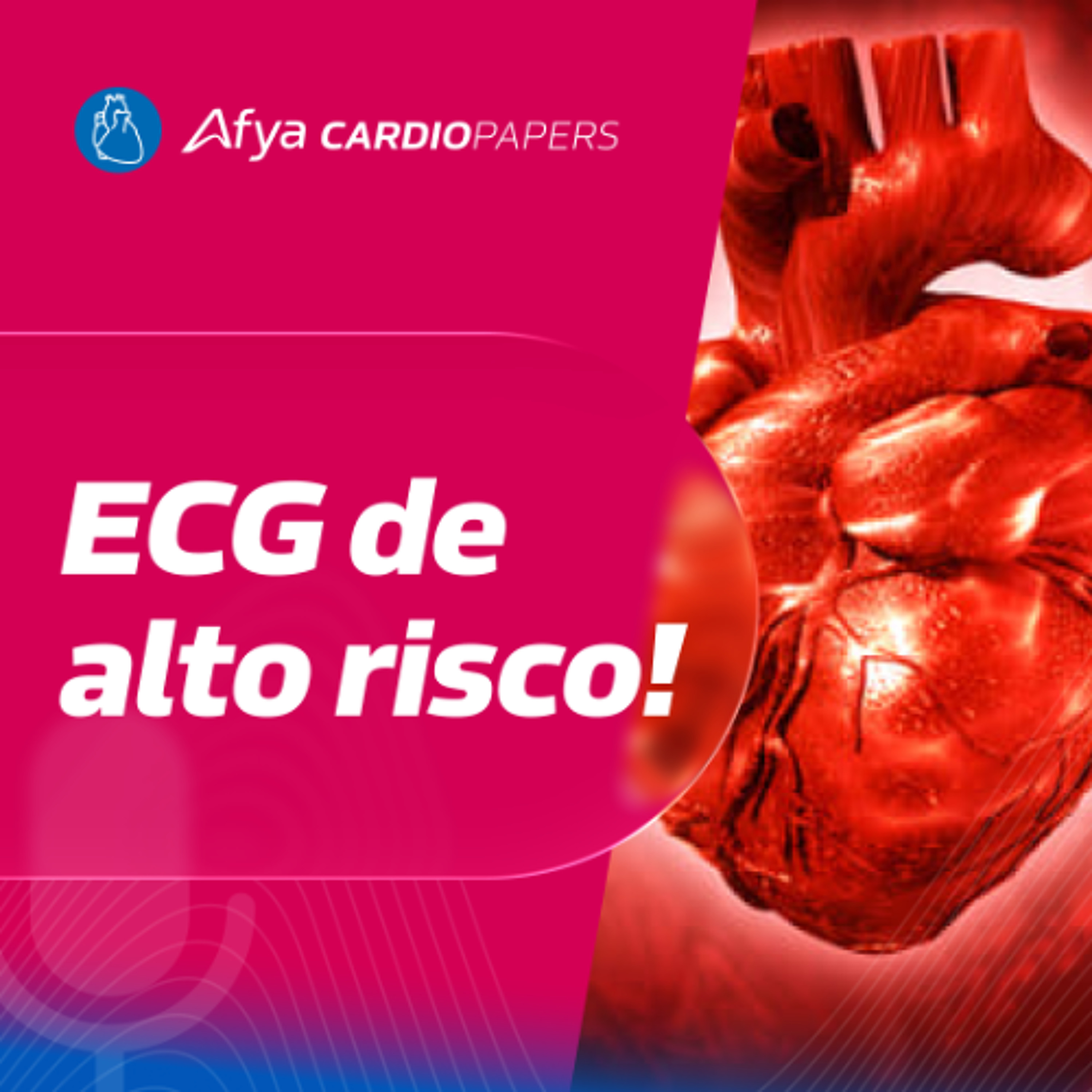 Padrões de oclusão coronariana aguda no ECG