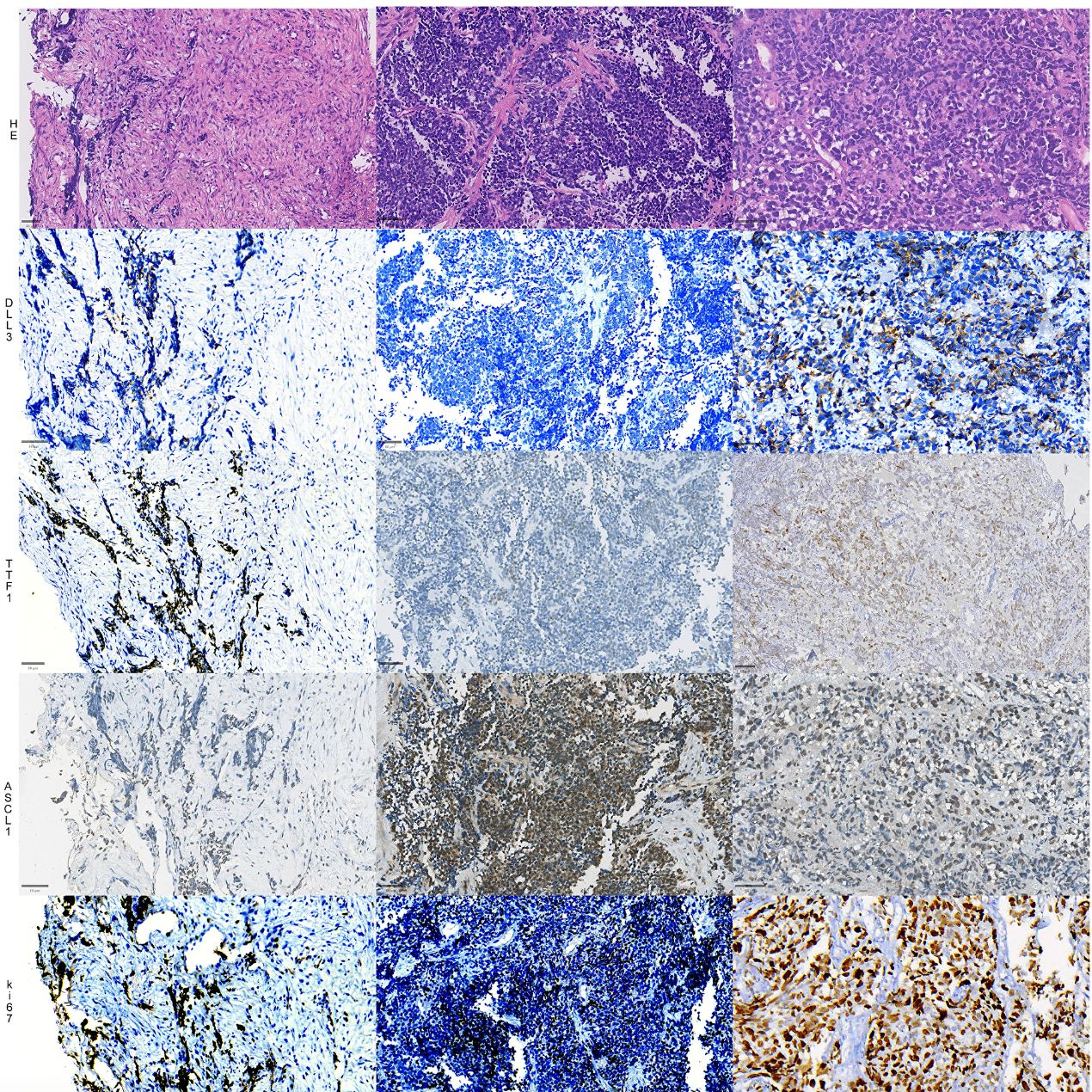 Oncotarget