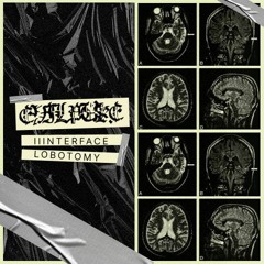 IIINTERFACE X LOBOTOMY