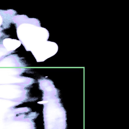 @y9ppa- stardust <3 (Prod. Betwixt) @DJ$HIPPY EXCLUSIVE