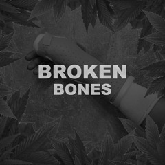 Save Your Bones