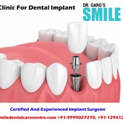 What Is Dental Implant & Best Clinic in Faridabad?